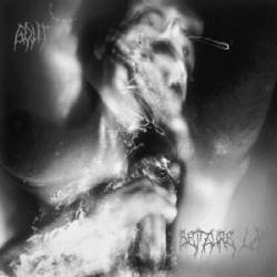 Gout (AUS) : Seizure Lab